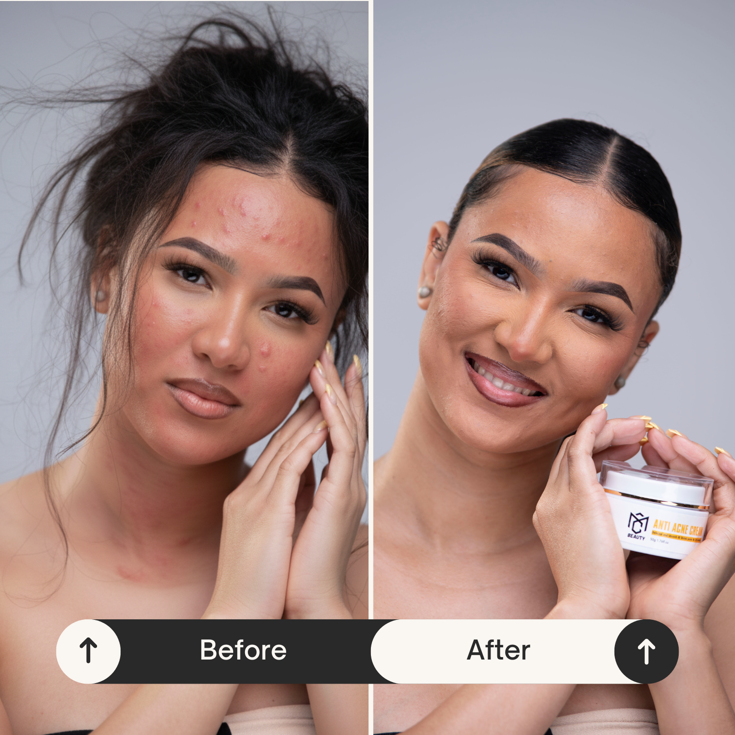 Brightening & Anti-Acne Glow Duo